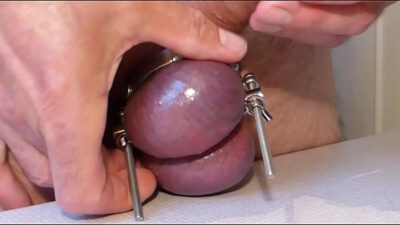 CBT – Separated Testicles